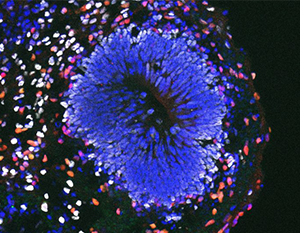 A rosette of an organoid at 14 weeks of differentiation